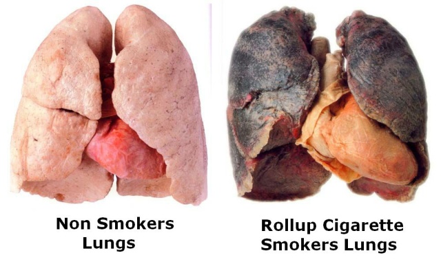 lungs-smoker-non-smoker