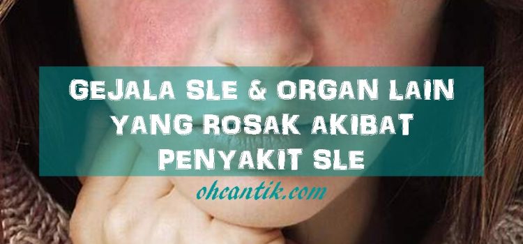 Penyakit SLE: Organ Lain Yang Turut Rosak
