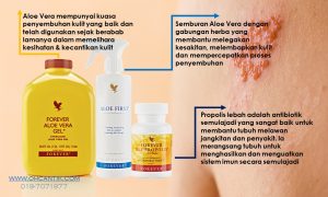 sembuhkan kayap