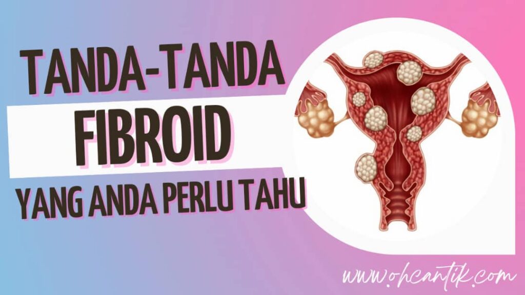 tanda-tanda fibroid